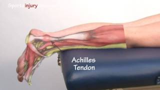 Achilles Tendonitis  Tendinopathy  Explained in 90 Seconds [upl. by Selrahcnhoj622]