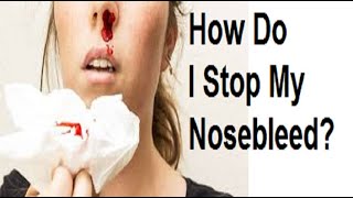 How Do I Stop My Nosebleed كيف أوقف نزيف الأنف [upl. by Alf]