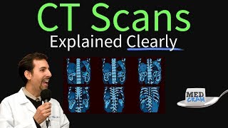 CT Scan of the Chest Explained Clearly  High Resolution CT Scan HRCT [upl. by Kally258]