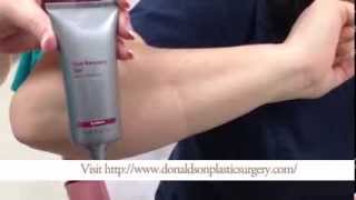 How To Apply Scar Gel or Cream [upl. by Ileek861]