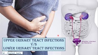 3 Upper vs Lower UTI Urinary Tract Infections [upl. by Aniryt]