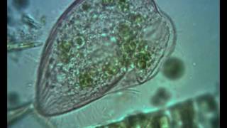 Blepharisma ciliate Contractile Vacuole in Action [upl. by Tremann]