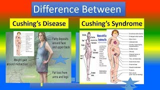 Difference Between Cushing’s Disease and Cushing’s Syndrome [upl. by Lindsey]