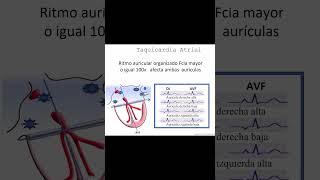 Cómo Tratar Taquicardias Guía Completa  Dr Jose Porto [upl. by Brenton]