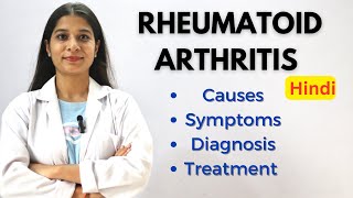 Rheumatoid arthritis  Causes Symptoms Diagnosis amp Treatment [upl. by Enrev]