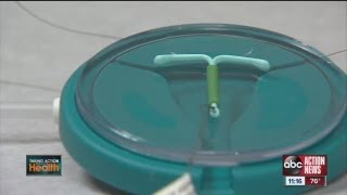 Mirena birth control may be causing complications in women [upl. by Sarge240]