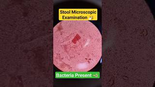 Stool test  Stool microscopic examination  Stool microscopy microbiology shorts trending viral [upl. by Treblihp53]