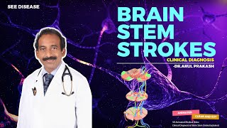 BRAIN STEM STROKES  Diagnosis and Localization  NEUROLOGY [upl. by Glaab329]