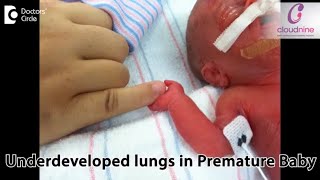 What happens when baby is born prematurely amp lungs are not developedDrIndu Khosla of C9 Hospitals [upl. by Hearsh]