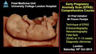 Anomaly Scan at 1113 weeks ISUOG 2013 approved course [upl. by Aleedis]