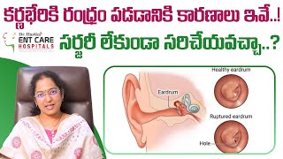 కర్ణభేరికి రంధ్రం  Causes of Perforated Eardrum  Hole in Eardrum  Dr Harika ENT Care Hospital [upl. by Bernelle]