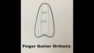 Finger gutter orthoticsplint in hand therapy setting [upl. by Swords]