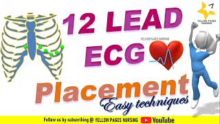 12 lead ECG placement  Easy techniques  Electrocardiogram [upl. by Herwin566]