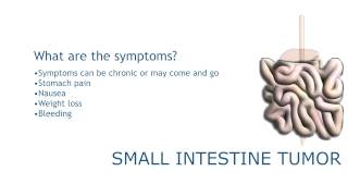 Tumors of the small intestine [upl. by Pulsifer]