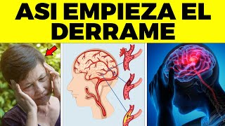 Así Empieza El Derrame Cerebral En Una Mujer  Signos Y Síntomas de Derrame Que Debes Conocer [upl. by Niltiac558]