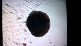 Beating 10 day old embryoid body from mES cells [upl. by Gonzalez]