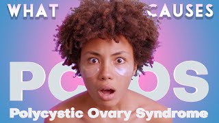 Why PCOS is More Than Just Ovaries [upl. by Nyloc]