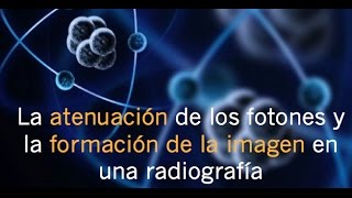 La atenuación de los fotones y la formación de la imagen en una radiografía [upl. by Cyndi]