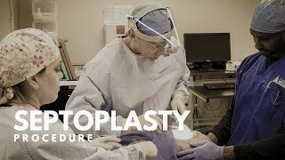 What is a Septoplasty Procedure [upl. by Emily]