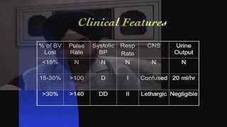 Hypovolemic Shock [upl. by Toby660]