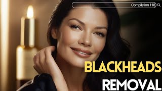 Skincare  Blackheads Removal 118 skincare skincare blackheads blackheads [upl. by Schmitz]