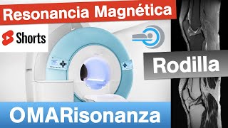 Resonancia Magnética🧲 de rodilla 4￼ resonanciamagnética rodilla salud shorts radiología [upl. by Sand174]