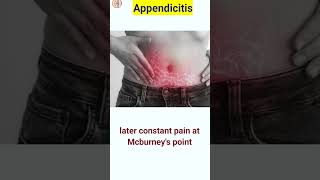 Appendix pain  appendicitis  shorts shortsfeed [upl. by Adeirf876]