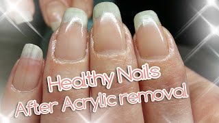 Acrylic Nail Removal  For Healthy Nails [upl. by Amadis]