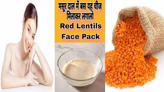 Skin Whitening Masoor Dal Face Pack Homemade Red Lentil Pack For Skin Acne Suntan And Dark Spots [upl. by Weigle432]