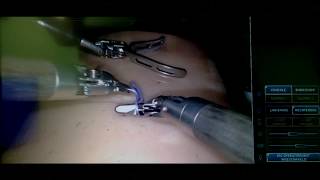 Surgical Knot Tying  Robotic Slipping Knot [upl. by Bywaters288]