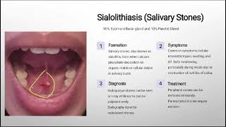 Diseases of salivary glands part 1 by Dr Fatima Ammir  Doc Haseeb amp Insia Academia [upl. by Alrep259]