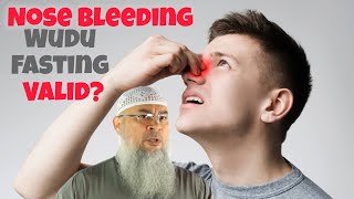 Does nose bleeding invalidate my wudu amp fasting Assim assimalhakeem assim assim al hakeem [upl. by Ainna173]