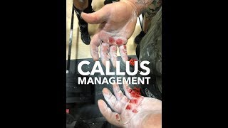 Callus Management for Deadlifts [upl. by Flann417]