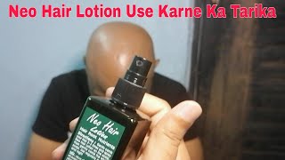 Neo Hair Lotion lagane ka tarika I Neo Hair Lotion How To Use Technical Aasif [upl. by Eirtemed]