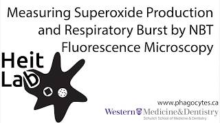 Detection of the Oxidative Burst by NBT Fluorescence Microscopy [upl. by Asamot698]