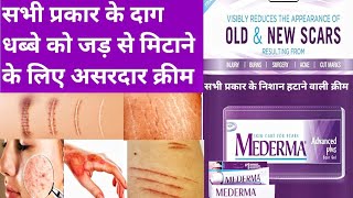 Mederma advanced Plus scar gel review how to remove burn marks acne marks stretch marks cut marks [upl. by Kalin]