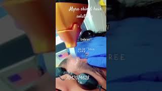 Laser hair removal for unibrow at Myra skin amp hair solutions Delhi laserhairremoval eyebrows [upl. by Olwen]