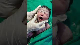 Essential care of new born baby after birth viralvideo littleprince mylittleprince mylittle [upl. by Darton]