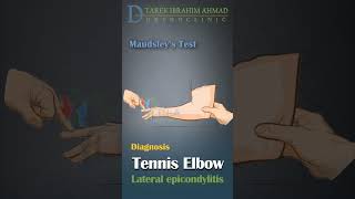 Maudeslys test for tennis elbow  lateral epicondylitis [upl. by Utter]