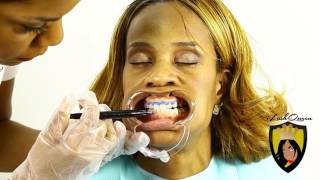 TEETH WHITENING TUTORIAL How to Start a TEETH Whitening Business amp Is Teeth Whitening Legal [upl. by Ajin726]