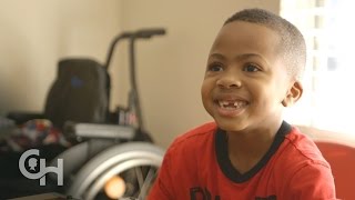 First Bilateral Hand Transplant in a Child Zions Story [upl. by Ellersick425]