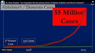 Dr Chris Knobbe onderzoekt de rol van plantaardige oliën als aanjager van chronische ziekten [upl. by Namharludba]