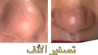 plasmapen fibroblast plaxel تصغير الأنف بدون عملية جراحية [upl. by Comptom312]