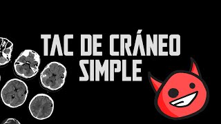 Principios básicos Tomografía TAC simple de cráneo [upl. by Kucik]