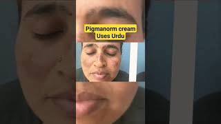 Pigmanorm cream Uses in urduHindi  Pigmanorm whitening cream  pigmanorm cream  Dr Nadeem [upl. by Ayikan987]