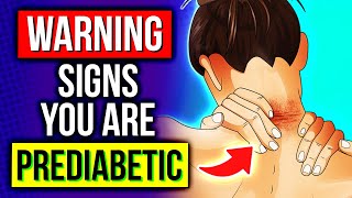 7 SIGNS Of PREDIABETES You Shouldnt Ignore [upl. by Anoli347]