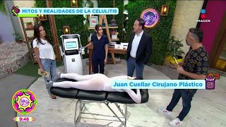 Diferencia entre celulitis y estrías  Mitos y Realidades  Sale el Sol [upl. by Cleveland]