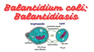 Balantidium coli Balantidiasis Clinical parasitology [upl. by Granese]