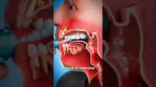 How An Inhaler Works 🤔viral shorts ‎drMaryamGull [upl. by Alitta]