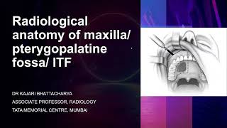 Radiological anatomy of maxillapterygopalatine fossa infratemporal fossa  Dr Kajari Bhattacharya [upl. by Loise420]